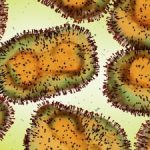 Aus state reports 1st monkeypox case since Nov 2022